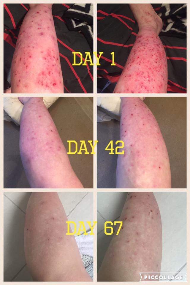 PerfectHealthyU's tweet photo. Skin conditions be gone! #berries #wholefood #nutrition #results #askmehow https://t.co/ANFvJ7AycY
