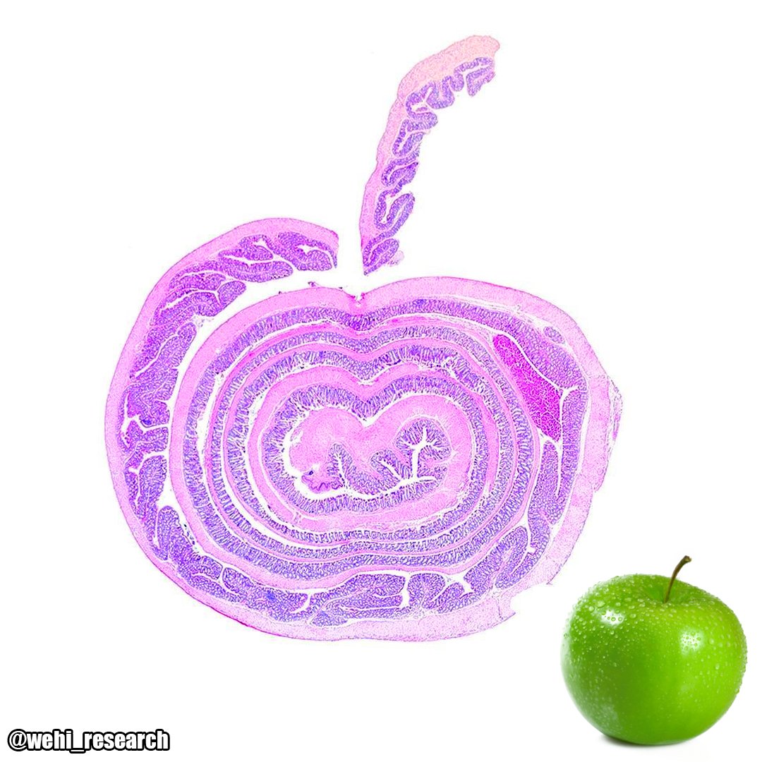IHeartHisto's tweet image. 🍏 a day keeps the bowel cancer away?
Gr8 news for keepin GrannySmith regular &amp;amp; Pippin 💩
📷🔬 = @WEHI_research #pathArt