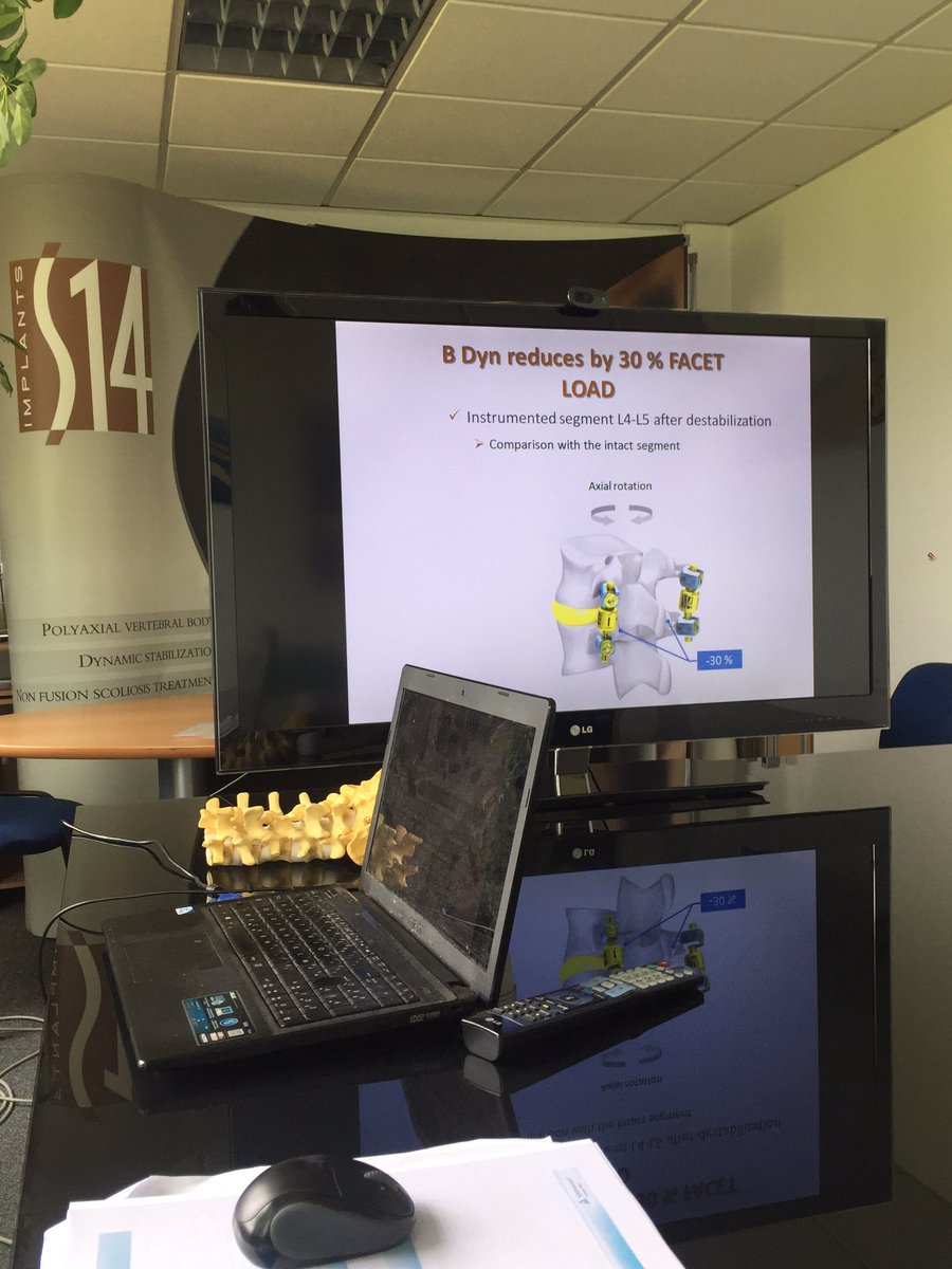 I was visiting a new and #innovative solution for #BackPain #Bdyn <a href="/neurocirurgiabr/">Julio Pereira - Neurocirurgião SP</a> @SpineWeek2016 <a href="/AANSNeurosurg/">AANS Neurosurgeon</a>