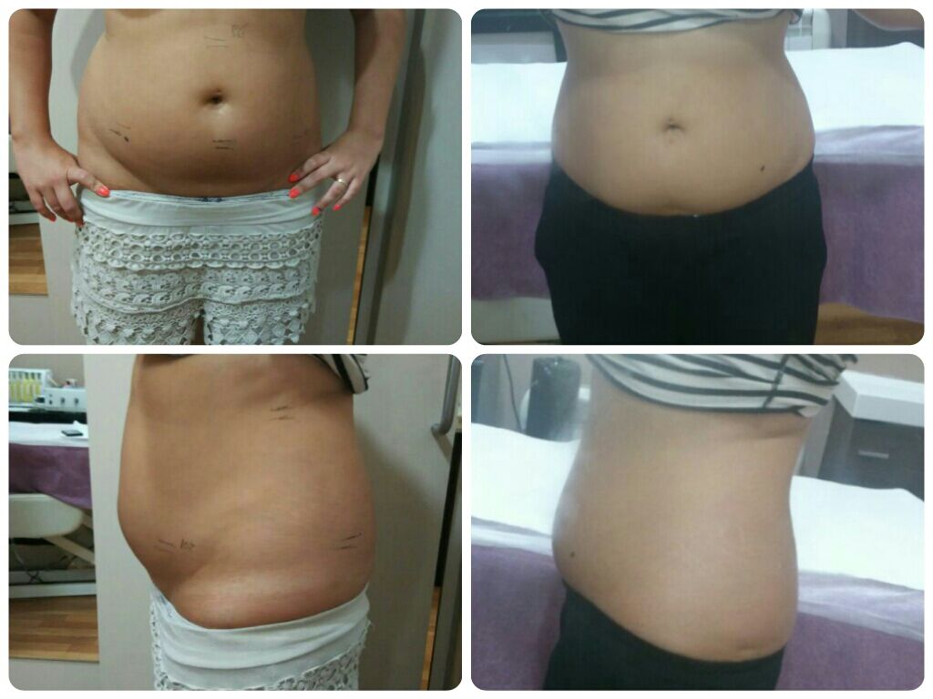 bellatuseras's tweet photo. @misdietas Gracias por el follow...si por hacer dieta estás interesados en reafirmar informate. https://t.co/Z5LQjg9jvc