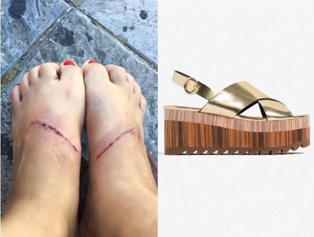 heraldoes's tweet photo. Unas sandalias de #Zara provocan quemaduras en los pies https://t.co/lPYngVGTlS #calzado #Inditex #salud https://t.co/l8KcvvxBec