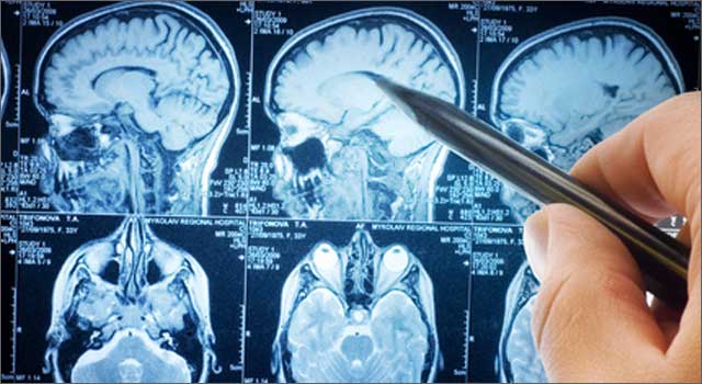 Conifarma's tweet photo. ¿Por qué el estrés aumenta las convulsiones en pacientes con epilepsia?
#Conifarma https://t.co/3g4xTmoEty https://t.co/kEaIHK9MBZ