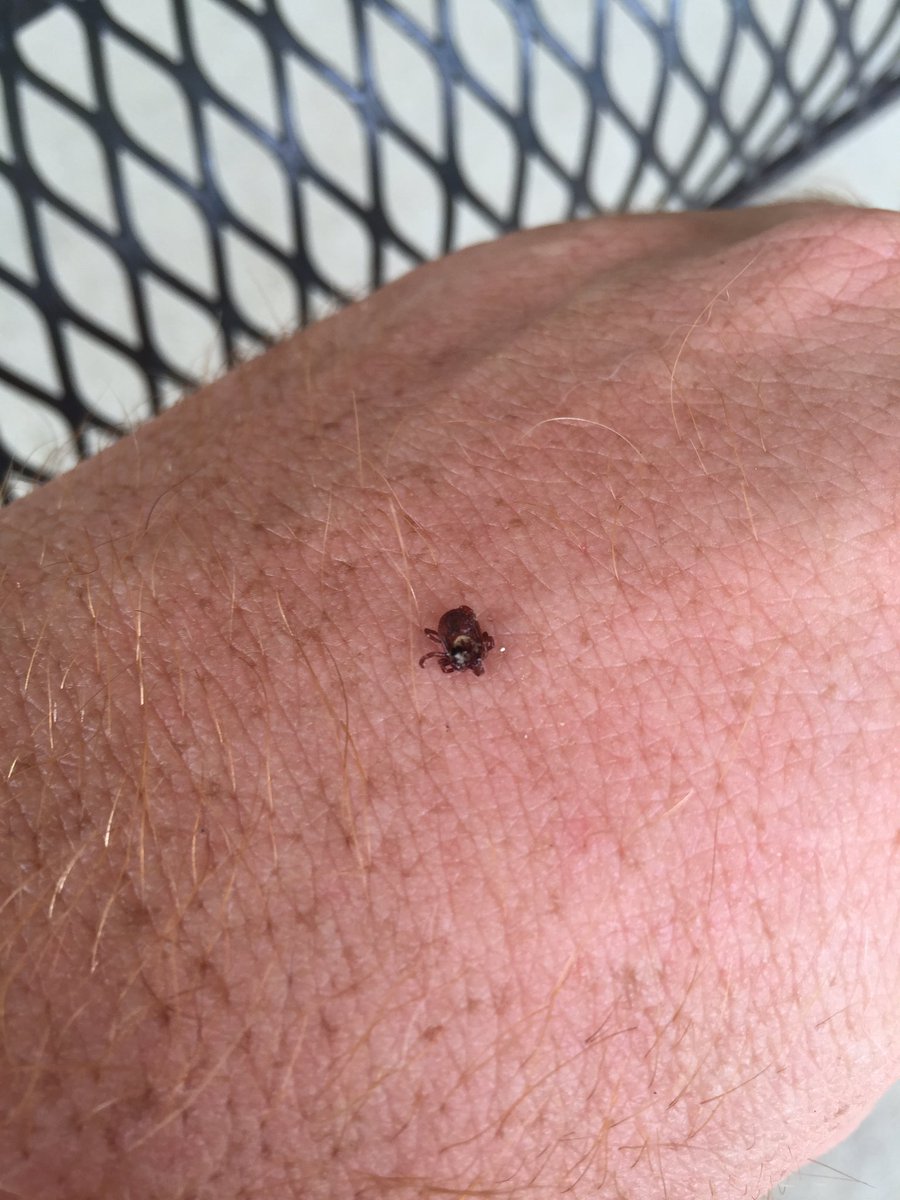 MFLA's tweet image. Morning run in the trails and came home to find this guy trying to make a home in my leg... #ticktime