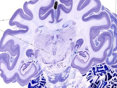 ScienceInPrague's tweet photo. Are we closer to revealing the origins of mammalian neocortex? Cell migration tells a story.
https://t.co/aYvpqXALei https://t.co/jtXKoFPCvS