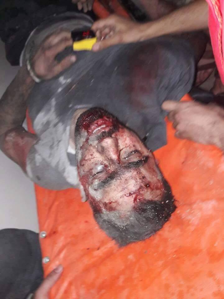 sahabatsuriah's tweet photo. Wartawan @HadiAlabdallah #Aleppo yg siarkan kejahatan2 rezim Asad/Rusia/Iran sdg kritis. Doakan! @RamiJarrah https://t.co/MOnsbN1M8U