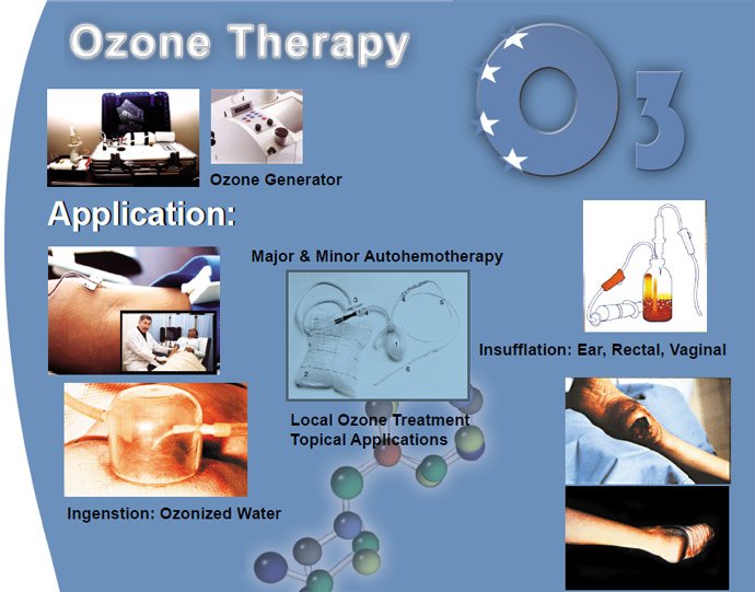 AustinOzone's tweet photo. #Ozonetherapy is an incredible rejuvenator, normalizer, #detoxifier, regenerator,#immuneenhancer & mental energizer. https://t.co/PQ8CEe4jTM