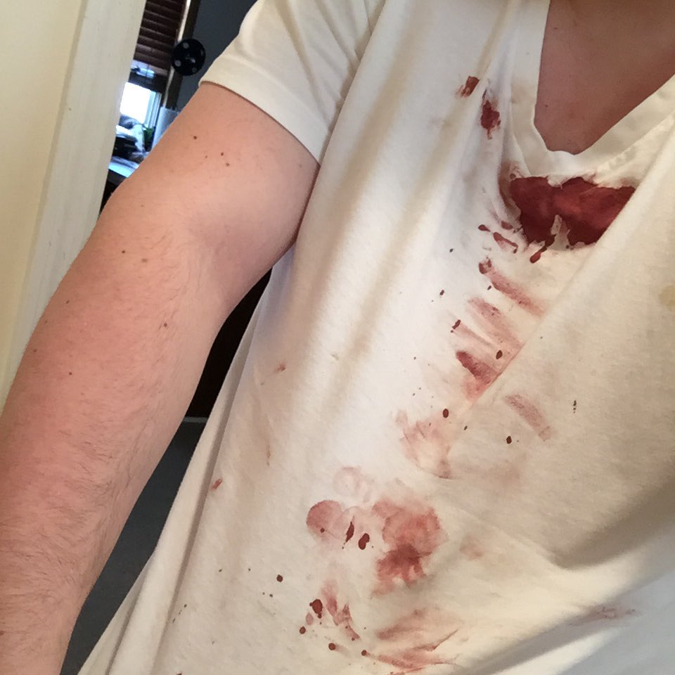 taailed's tweet photo. Bloody nose during CS:GO comp @Zeus_yo @FaZeDrag https://t.co/HzCSuhxeUZ