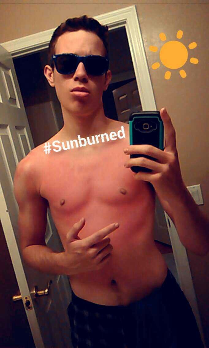 Im_Squints's tweet image. Never NOT wearing Sun Block!!!