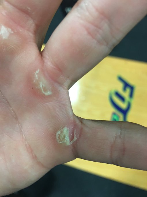 Muscle snatches and tears @WODRepairLotion https://t.co/F1Id1xHqfS<a class="tags" target="_blank" title="On Twitter" href="/?out=eyJ0eXAiOiJKV1QiLCJhbGciOiJIUzUxMiJ9.eyJpYXQiOjE3MjU4NTQ4OTAsImlzcyI6InR3cG9ybnN0YXJzLmNvbSIsIm5iZiI6MTcyNTg1NDg5MCwiZXhwIjoxNzU3MzkwODkwLCJyZWRpcmVjdF91cmwiOiJodHRwczovL3R3aXR0ZXIuY29tL1dPRFJlcGFpckxvdGlvbiJ9.etnyuceUQ2o69hgYZJj-w76raBBKuatxc1oga-NqsDuscajum-XUSDR9Q0iKBskasLsm1WMHCl-3Pz7HoZJj-g">@WODRepairLotion</a><a href="/tag/twitchtv"class="tags"><span>#twitchtv</span></a>