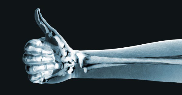 What Human Body Flaws Should Be Redesigned? buff.ly/21qTUqk