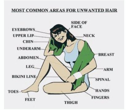studioemurrieta's tweet photo. Most common areas treated with #electrolysis.  #electrology #murrieta #studioemurrieta #GrandOpening #hairremoval https://t.co/RfCxAsK79m