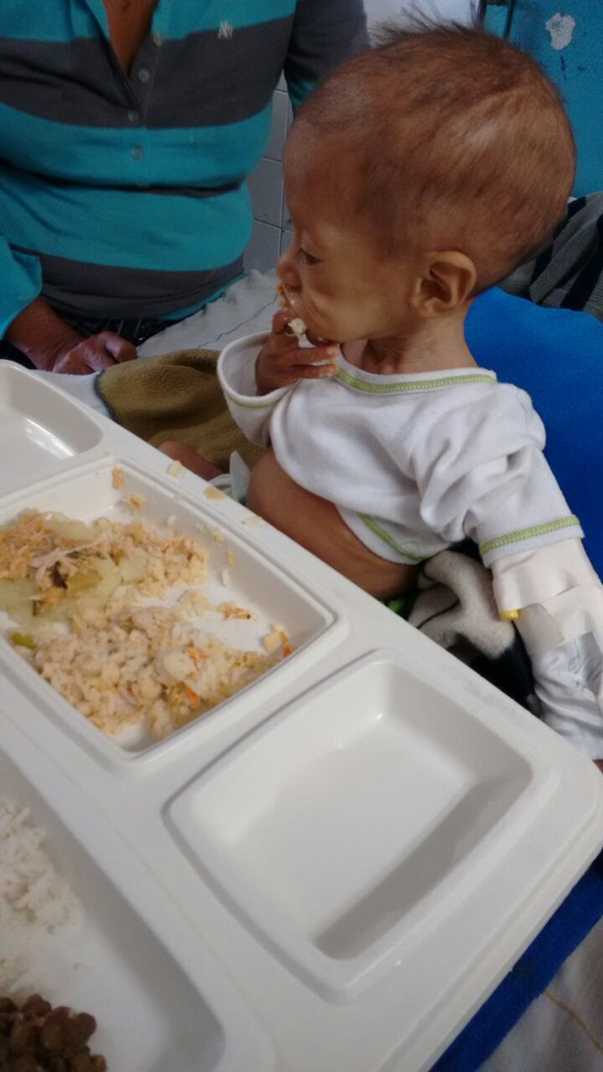 El pecado no es tener hambre,
el DELITO que no
debe prescribir JAMÁS
es que mueran en Vzla
niños por hambre