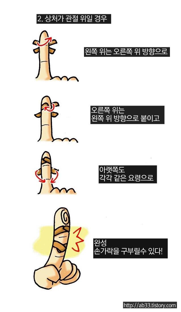 NZ__AMY's tweet photo. 반창고 잘붙이는법이래 혁명이다아 👏🏻 https://t.co/Ggl6WOtkBB