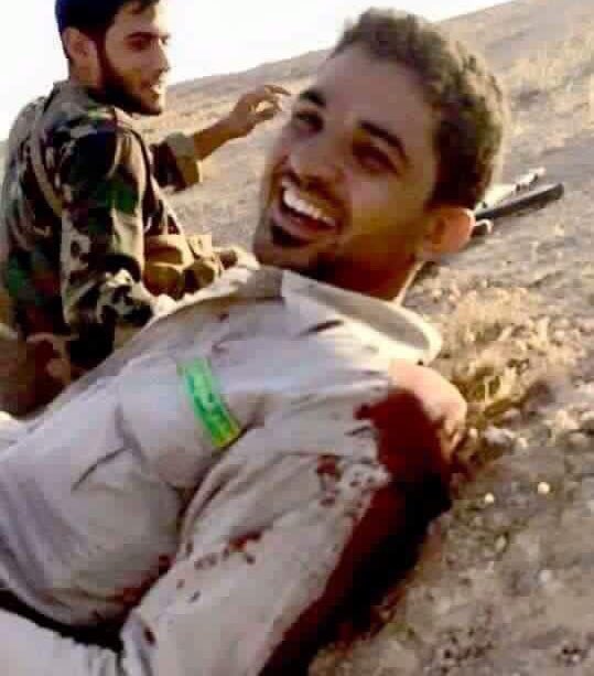 صورة اذهلت الملاين .. احد افرد الحشد الشعبي مصاب  . يبتسم قبل ان يموت...  ..... الفرح في وجوههم ..