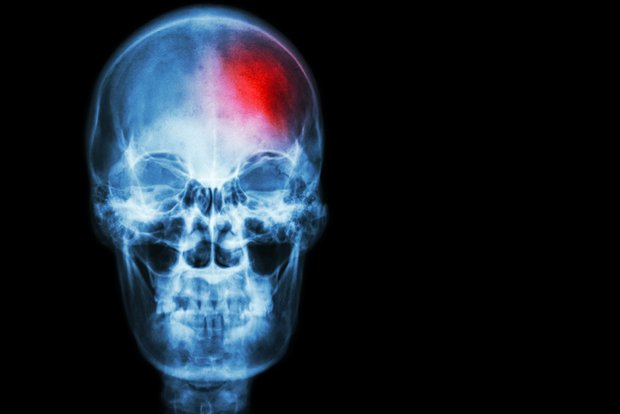 kascope's tweet photo. What's happening in the #Medtech world? https://t.co/teAixybQYG #productdesign #innovation #connectedevices https://t.co/E99fYN30yd