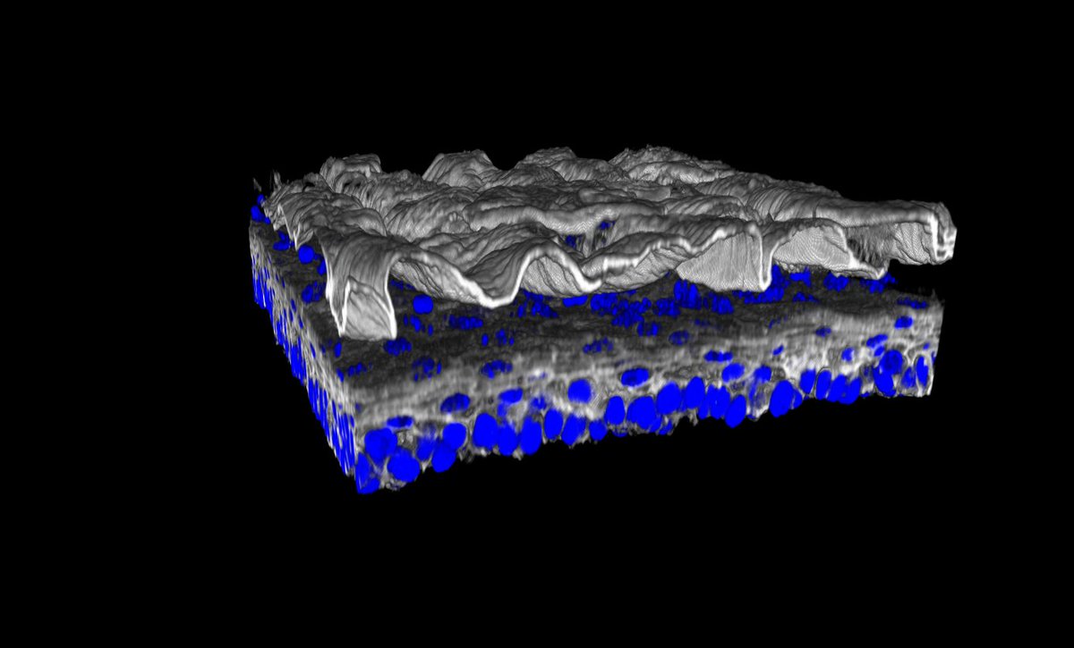 LupinCambridge's tweet image. To shed or not to shed
#3Dconfocal #Oesophagus #tightjunctions #keratinocytes #Epithelium