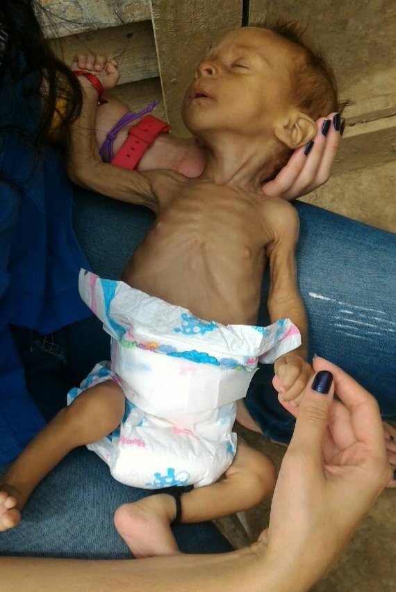 MayVenezolana's tweet image. AYUDA!!!! NECESITA:Comida, leche 04241644581 Este bebé vive en Yuma, Carabobo crisis q enfrentamos en Venezuela.🙏🏻🆘