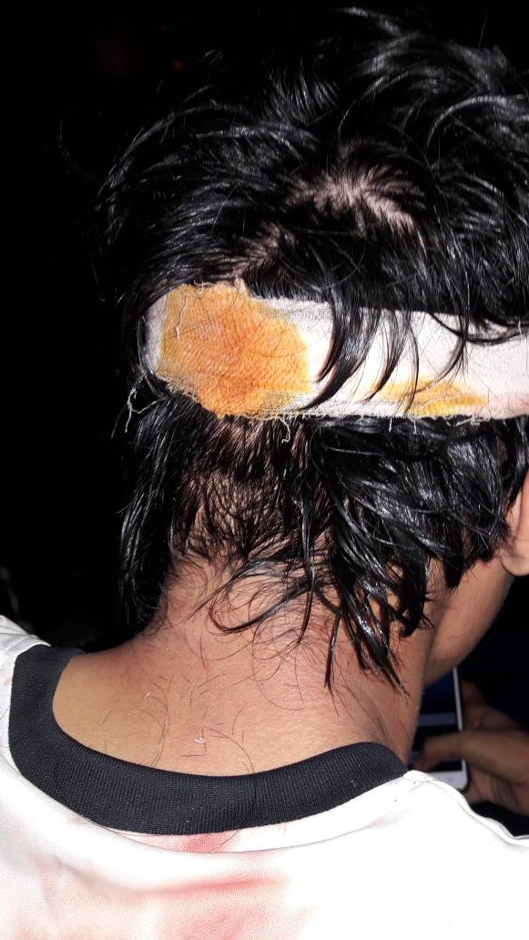 Gws buat riyan jak school pademangan , yg dikroyok pengamanan arema 👊 #PersijaDay <a href="/MB_Famiglia/">Mental Baja Famiglia</a> <a href="/jak_pademangan/">JU.17</a>