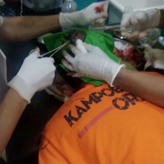 JakCikampek's tweet photo. Keep Fight! Salute denger ceritanye soal crew yg jadi korban ini! Pala keluar darah terus, masih segan tuk melawan! https://t.co/yVeju5eIX0