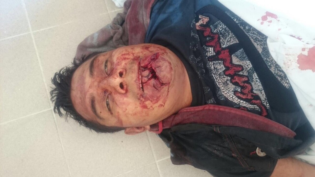 oaxacain's tweet photo. 2 muertos en Nochixtlan: Andrés Aguilar Sanabria de 23 años, y Yalid Jiménez Santiago, de 28 años, baleados https://t.co/Y23CvI4PrY