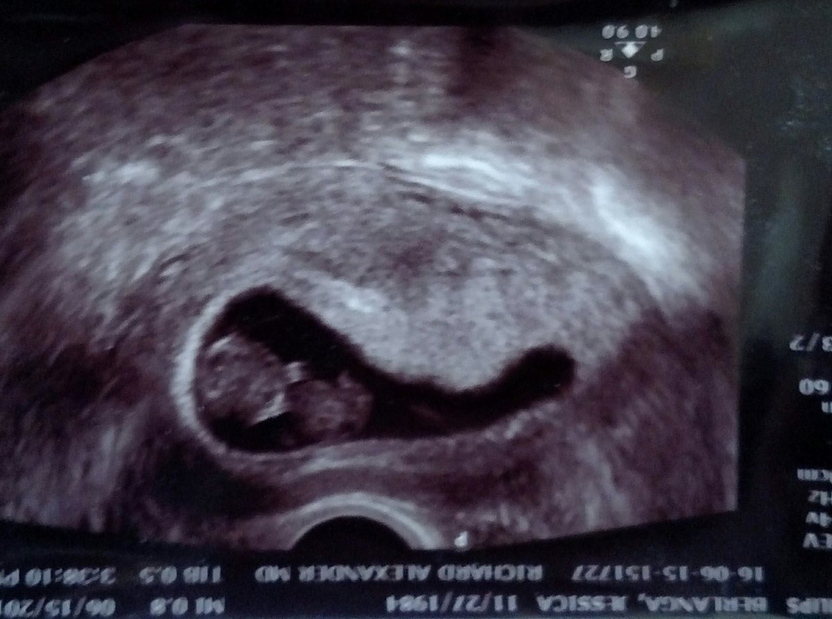 coachABerlanga's tweet photo. My 1st Father's Day. Look who is gonna be a daddy! 🙌💪
😎 #FathersDay #PraiseTheLord #MyFirstKid #OurBlessingToBless https://t.co/ZbQnK4LdH5