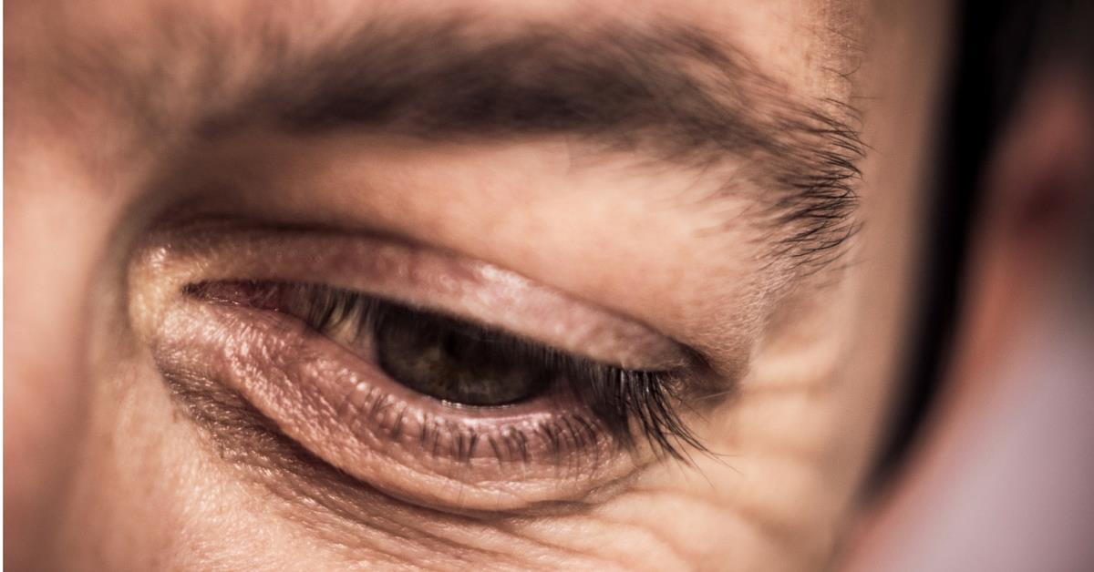 removefacew's tweet image. Do u know that people after the age of 35 tends to have more visible eye bags &amp;amp; wrinkles? removefacewrinkles.com