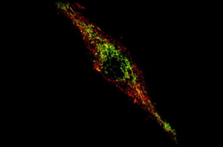 NeuroscienceNew's tweet photo. Overactive Immune System May Be Responsible for Cell Death in Parkinson's https://t.co/MVmSM03hcJ https://t.co/WN1myD99rq