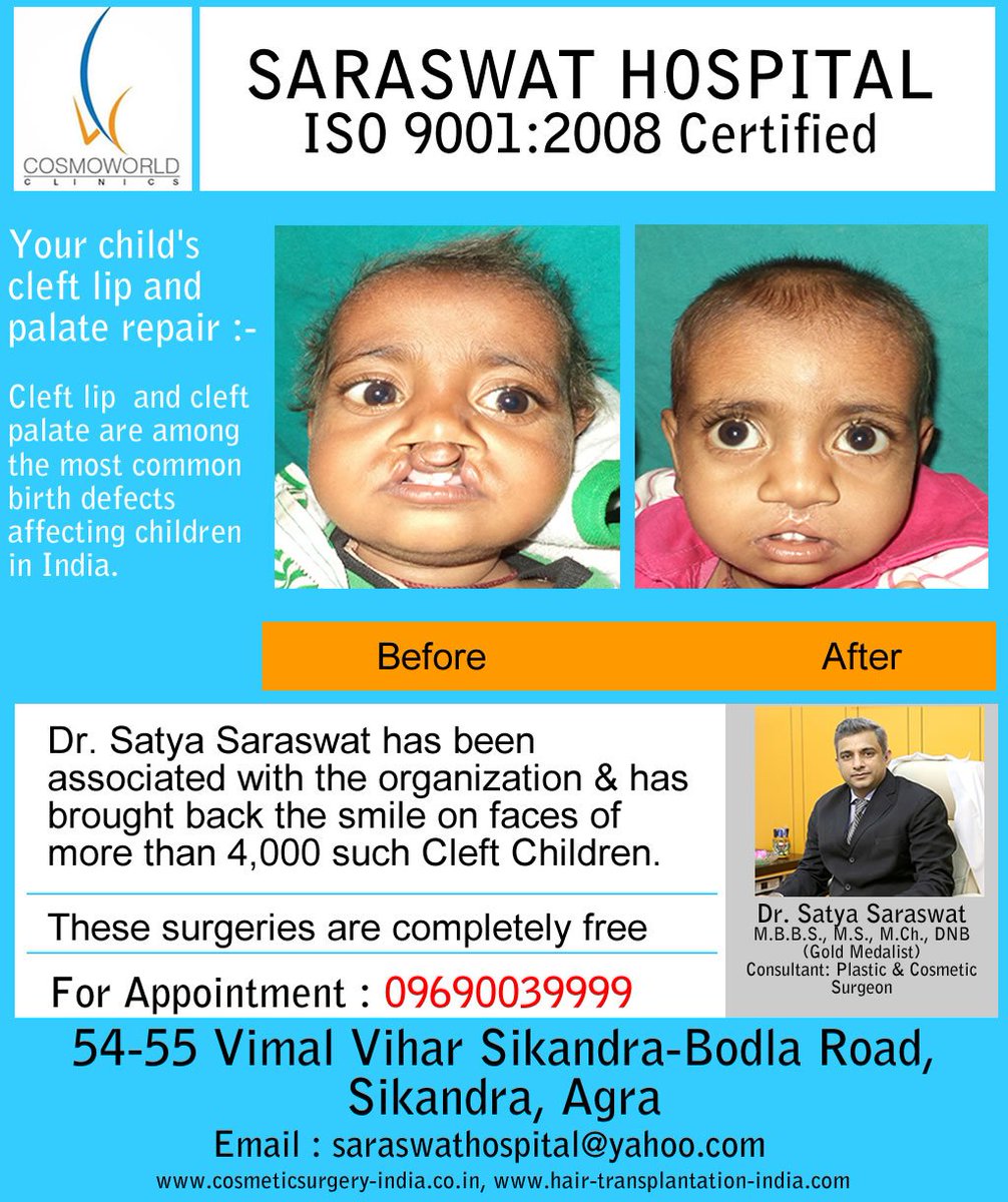 DrSatyaSaraswat's tweet photo. #CleftLipAndPalate #BioFUE #HairTransplant #CosmoworldClinics #SaraswatHospital https://t.co/kFqaxzecqP
