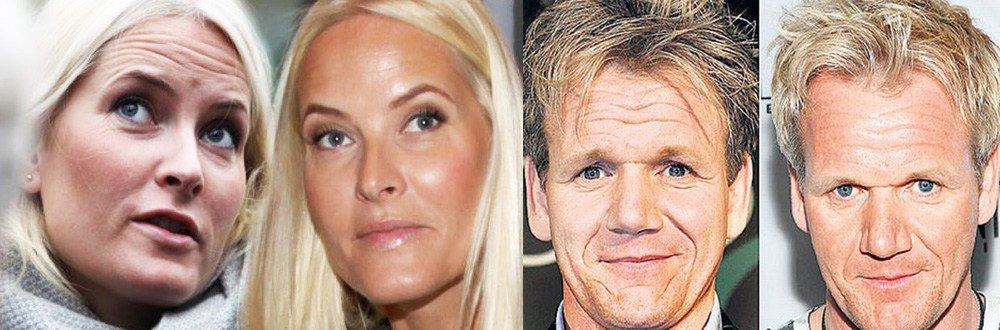 corporalcore's tweet image. El BOTOX funciona!!! corporalcore.com/el-botox-funci…