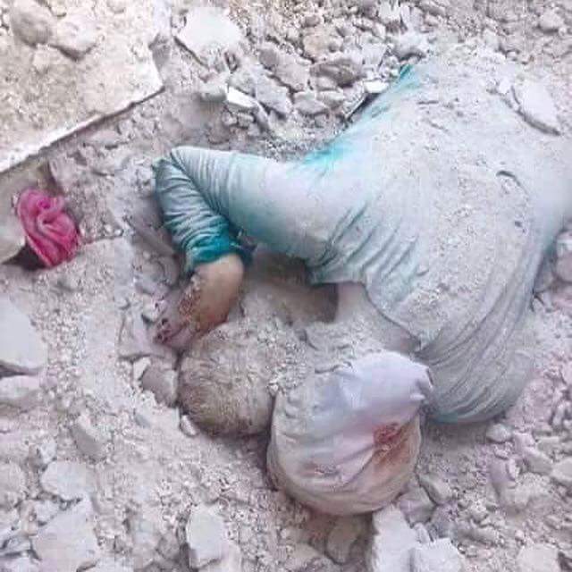 ام يمنيه تحتضن طفلها وتموت معه اثر القصف السعودي على اليمن أي اسلام هذا وأي عرب هؤلاء