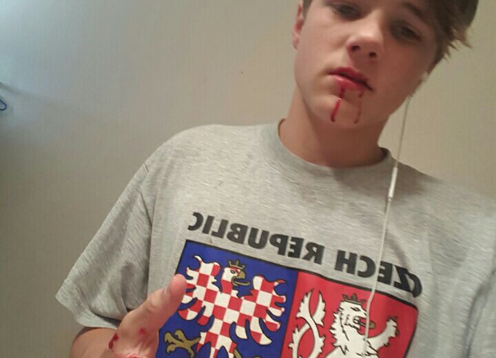 MethLabbs's tweet image. Throw back to when I fell getting food 😂