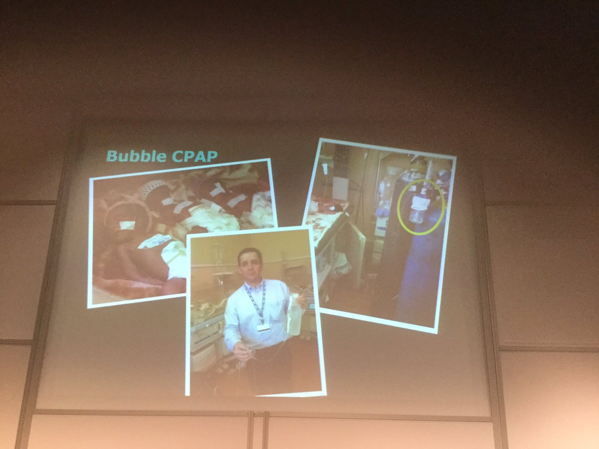 PamHar8's tweet photo. @NHSG_IPC Bubble CPAP Blue Peter style @GaryMortABZ @NHSGrampian https://t.co/B3s4gzUewY