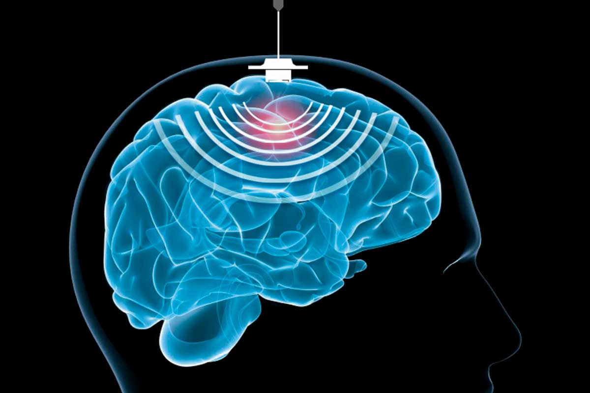 LBWCancer's tweet image. A new study uses microbubbles to help #chemo drugs reach brain tumours. 
Read here: bit.ly/28LE2Pc
#cancer