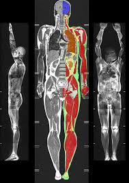 tipoist's tweet photo. WHOLE BODY MRI https://t.co/BSeGUQWSdu