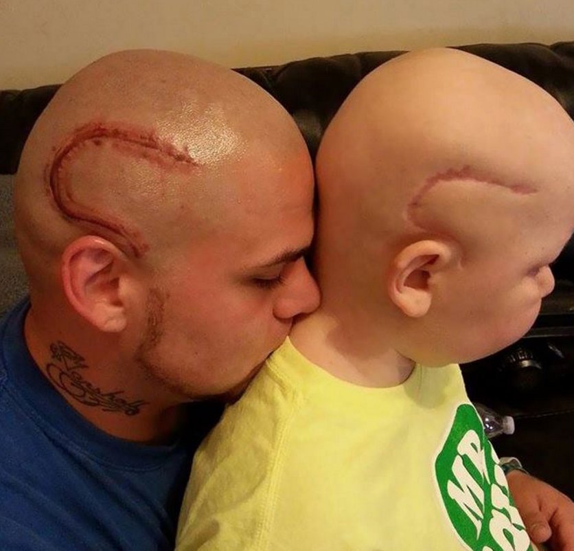 UNILAD's tweet image. Dad tattoos his son's cancer scar on his own head to boost son's self confidence...