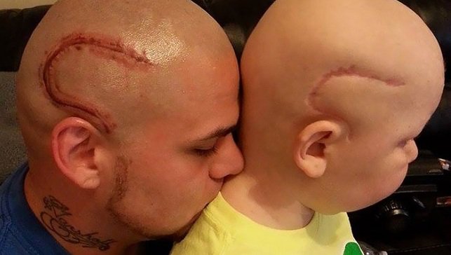 HLN_BE's tweet photo. Deze papa laat kankerlitteken van zoon op hoofd tatoeëren: "Als mensen willen staren,… https://t.co/w8zDDYWBwn #hln https://t.co/WSrQjbmtwt