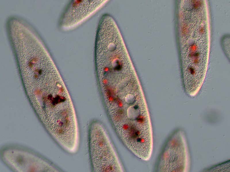 小林 康一 K Kobayashi 今日のゾウリムシ実習 実習内容とは離れるが コンゴーレッドミルクによる食胞 の観察をやってみた コンゴーレッドミルクをある一定時間与えたのち 塩化ニッケルで細胞を麻酔し 微分干渉観察 消化の過程で食胞内のphが変化する