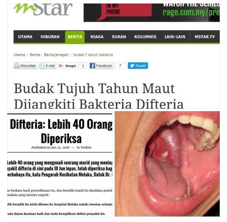 khairul_hafidz's tweet image. Pernyataan Dr @suhazeli , mengenai isu Diphtheria yang telah meragut nyawa sekarang ini #ProVaksin #MedTweetMY