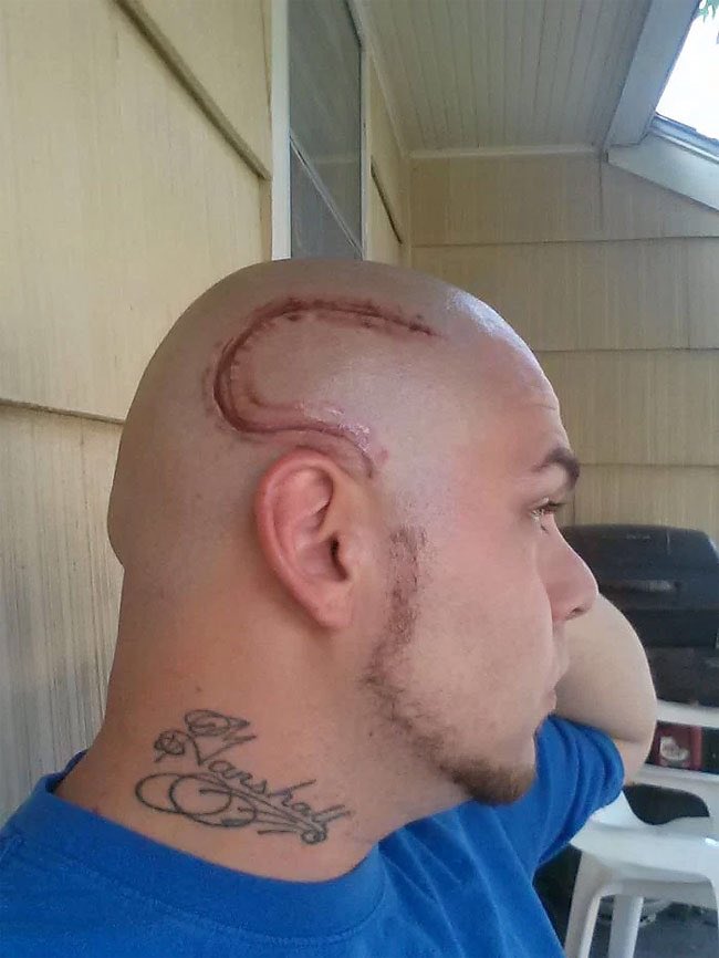 deadcatssociety's tweet image. 아들의 뇌종양 수술 흉터를 문신한 아빠