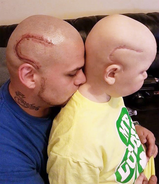 deadcatssociety's tweet image. 아들의 뇌종양 수술 흉터를 문신한 아빠