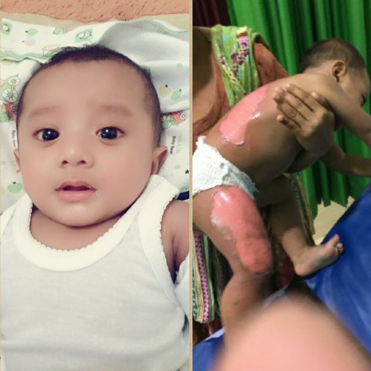 FADIANA93's tweet photo. Minta doanya buat keponakan aku yah.. Mudah2n cepet sembuh.  Amin https://t.co/IvKIyWxLMy