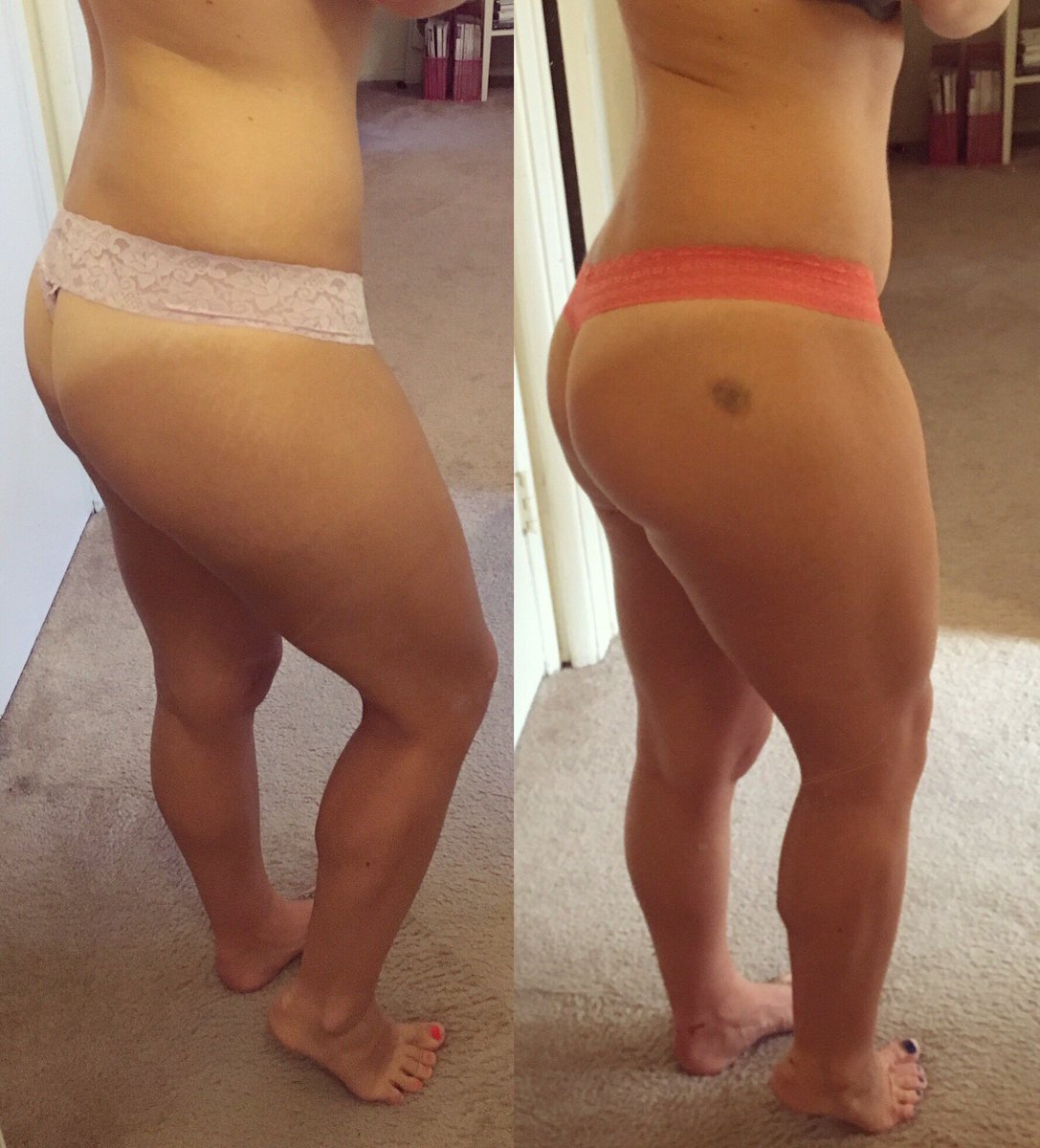 Nikkirk7's tweet image. #growbootygrow 3 Weeks of lifting heavy weights at the gym #bootygoals #liftingprogress #progress #beachbum #lifting