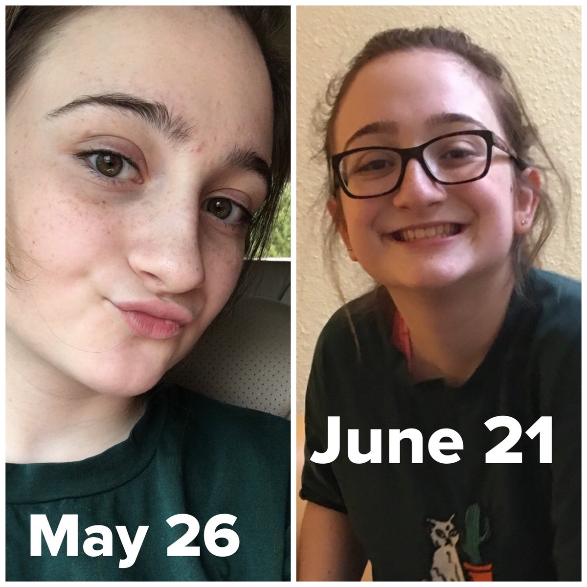 LymePrincessSam's tweet photo. Healing IS happening!!  #Germany #LymeDisease #GodIsGood https://t.co/n3XXKw4O1Z