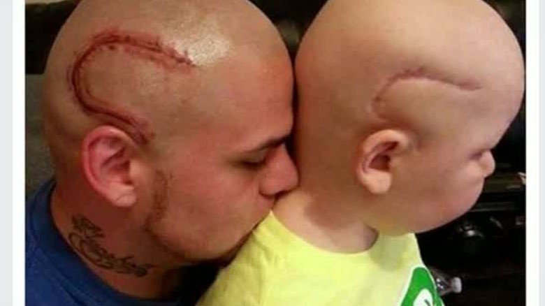 CNNEE's tweet photo. Padre se tatúa en la cabeza la cicatriz de su hijo con cáncer 
https://t.co/NSCcESCwz3 https://t.co/xPfWIHjAgs