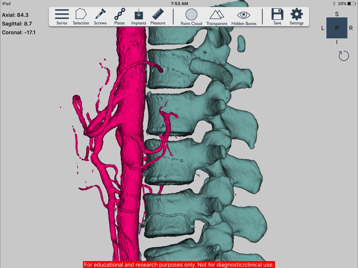 Conceptualiz_'s tweet photo. Simplified #3dprinting for #physicians: empowering them to express their #3dprinting creativity #CNSF2016 https://t.co/mwLHucs44s
