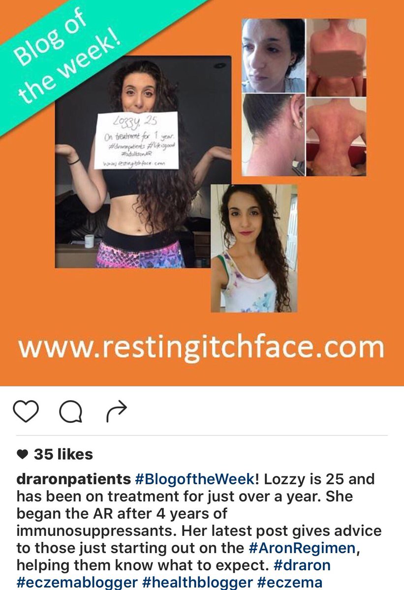 DrAronEczema's tweet photo. https://t.co/GsIYqdFEDA #DrAron #Dermatology #AtopicDermatitis #Eczema #Dermnews #ClearSkin #Healing #ItchFree #Blog https://t.co/IUQOXoR9LH