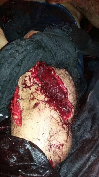 Alwillaya's tweet image. يارب بحق هذا الإذن أرنا قدرتك في من ظلمنا من ال سعود و ال خليفة و من والاهم ...
#الشهيد_عبدالرحيم_الفرج #العوامية