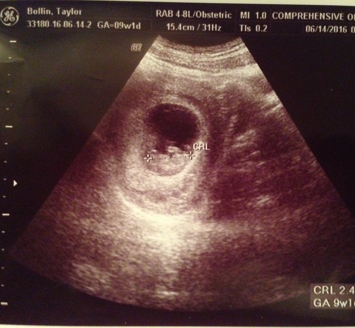 HalenByrd's tweet photo. My little Strawberry. 10 weeks and 2 days @taybollin https://t.co/iOJKquaJTG