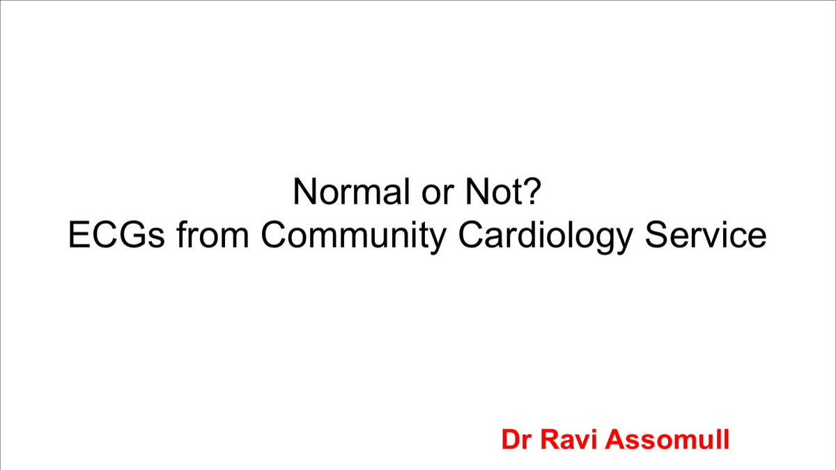 ECGclass's tweet image. PM session: ECGs from the community. Normal or Not? What do you do next? #ECGClass @WLondonCCG @NHSCLCCG @NHSHFCCG