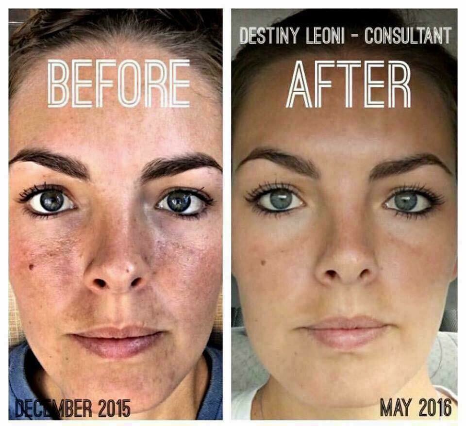 PriarAmy's tweet photo. Destiny 
“I’m so pleased with how far my skin has come REVERSE regimen R+F has something for everyone!”
#RealResults https://t.co/r5O32LNm8j